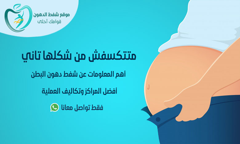 عملية شفط دهون البطن